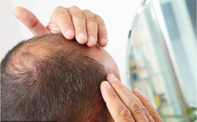 CC1Y-fynwnws0792849 CC1Y-fynwnws0792849