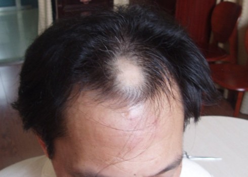 1795c47de6a04bc6a045c5c18878fc3e_th 1795c47de6a04bc6a045c5c18878fc3e_th