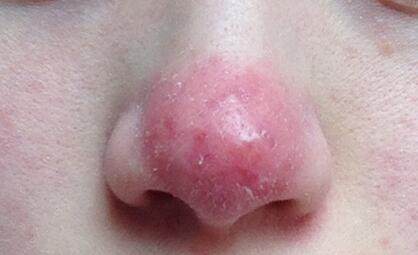 u=2356154525,2338828578&fm=173&s=D13180759C6F532C40AC42F50300C026&w=418&h=255&img u=2356154525,2338828578&fm=173&s=D13180759C6F532C40AC42F50300C026&w=418&h=255&img