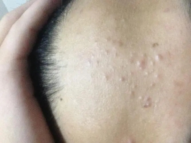 1-23021Q05K62S 1-23021Q05K62S