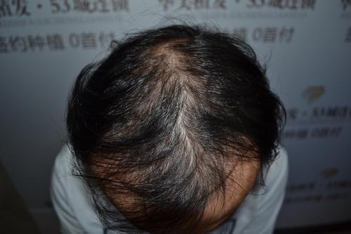 1-230615101Z19D 1-230615101Z19D