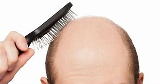 1-22100G6231a96 1-22100G6231a96