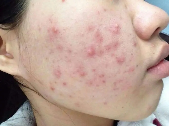 1-230203134S6342 1-230203134S6342