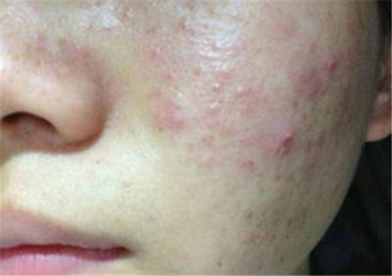 u=3066038477,3823663962&fm=170&s=C5E8935509266F3E889049EA0300E033&w=570&h=402&img u=3066038477,3823663962&fm=170&s=C5E8935509266F3E889049EA0300E033&w=570&h=402&img