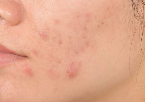 316bd60a98805b9fe4ab4be28fa90f5b_dou-dou-de-zhong-lei-qiu-zhen-zheng-zhuang-tu-pian 316bd60a98805b9fe4ab4be28fa90f5b_dou-dou-de-zhong-lei-qiu-zhen-zheng-zhuang-tu-pian