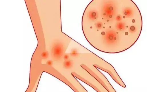 1-220HG61425421 1-220HG61425421