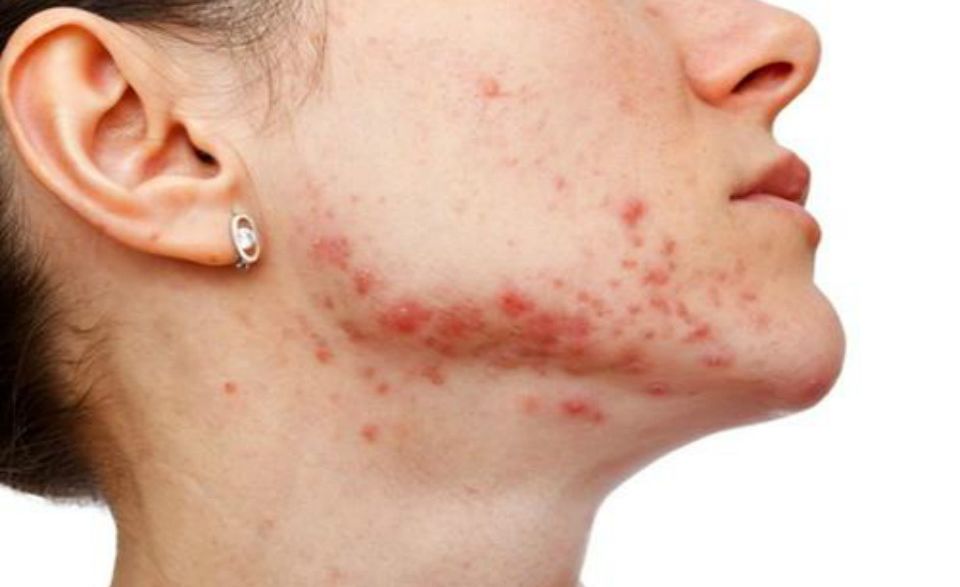 1-220419104UVO 1-220419104UVO